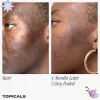 Topicals Faded Serum for Dark Spots & Discoloration - Imagen 5