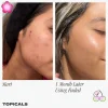 Topicals Faded Serum for Dark Spots & Discoloration - Imagen 3