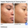 Topicals Faded Serum for Dark Spots & Discoloration - Imagen 2
