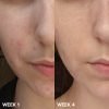 Paula's Choice C15 Vitamin C Super Booster - Imagen 2