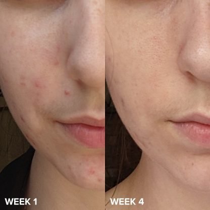 Paula's Choice C15 Vitamin C Super Booster - Imagen 2