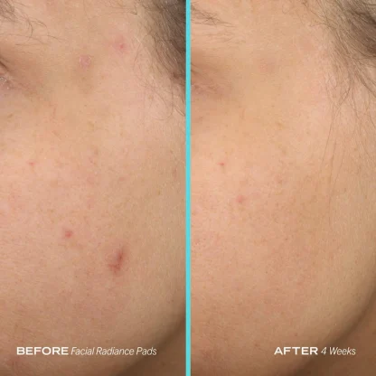 First Aid Beauty Facial Radiance Pads with Glycolic + Lactic Acids   60 Pads / pack - Imagen 7