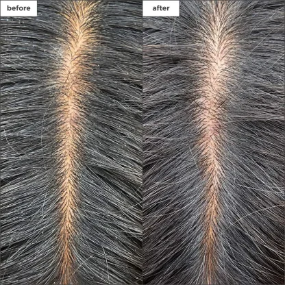 Briogeo  Scalp Revival™ Charcoal + Tea Tree Cooling Hydration Mask for Dry, Itchy Scalp 59ml - Imagen 6