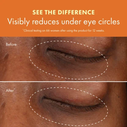 Origins  Ginzing™ Vitamin C Eye Cream to Brighten and Depuff (Original / Cool) - Imagen 4