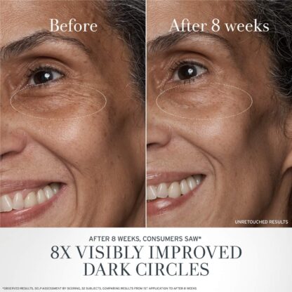 Fresh Black Tea Advanced Age Renewal Eye Cream  15ML - Imagen 5