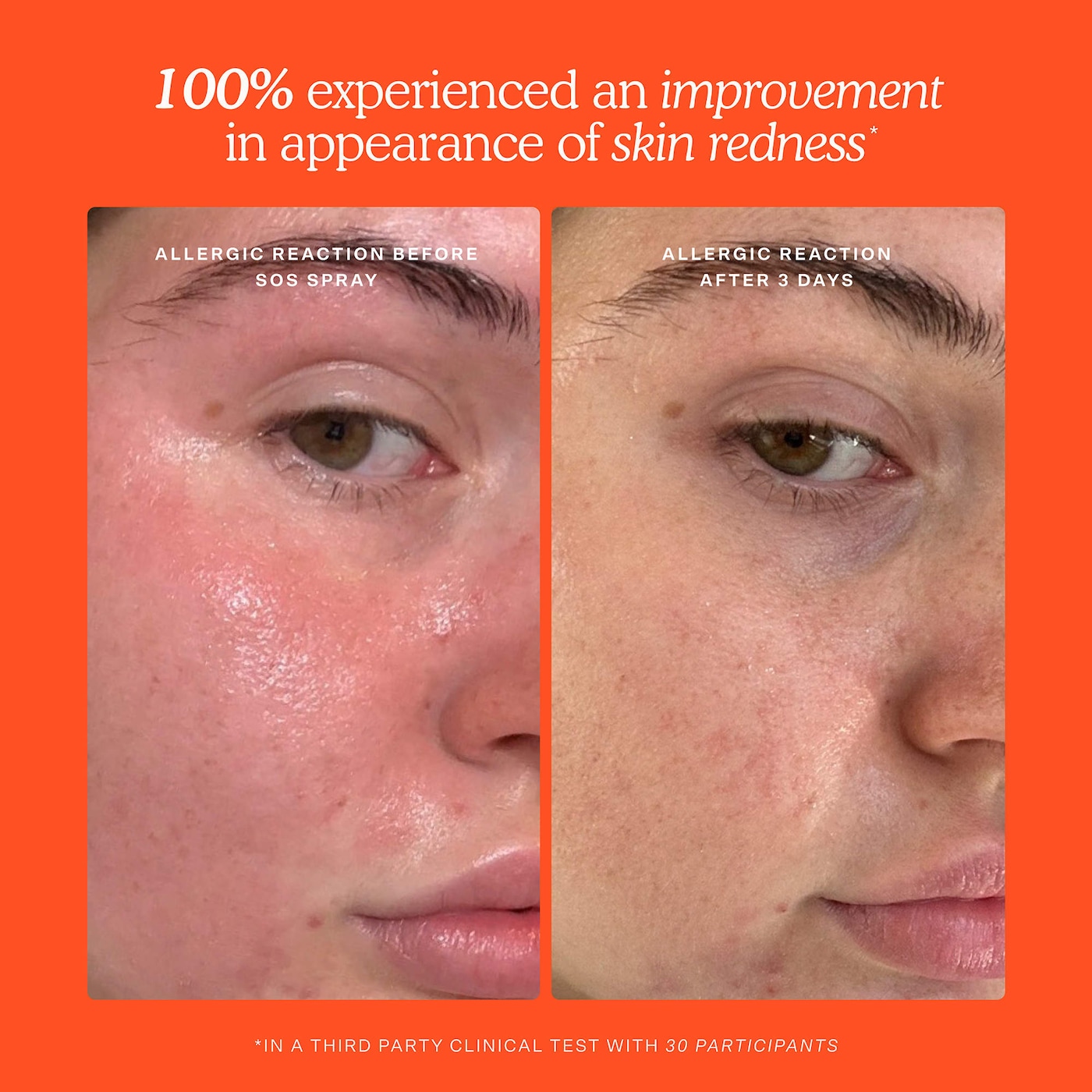 Tower 28 Beauty Mini SOS Skincare Bestsellers Set - Imagen 2