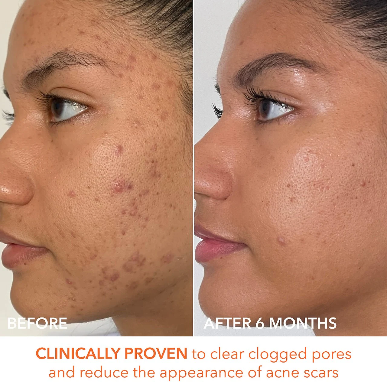 Dr. Dennis Gross Skincare Mini Alpha Beta® Extra Strength Daily Peel Pads - Imagen 7