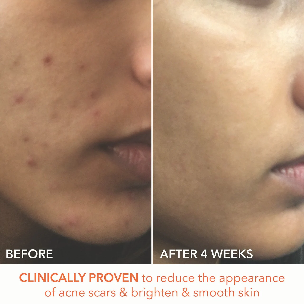 Dr. Dennis Gross Skincare Mini Alpha Beta® Extra Strength Daily Peel Pads - Imagen 6