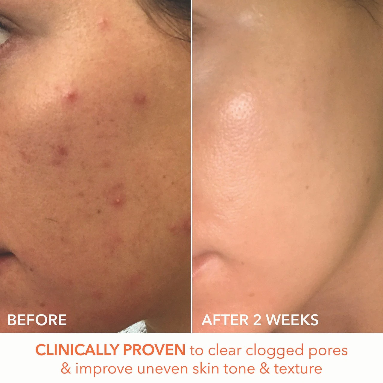 Dr. Dennis Gross Skincare Mini Alpha Beta® Extra Strength Daily Peel Pads - Imagen 3